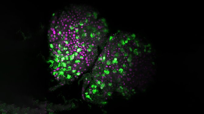 Afbeelding van een met AcMNPV-virus geïnfecteerde hersenen uit een vloeibaar geworden rups van Spodoptera exigua (de bonenspintmijt). Deze afbeelding is gemaakt met een confocale laserscanmicroscoop. Magenta toont celkernen en groen het virus. (Foto: Simone Nordstrand Gasque)