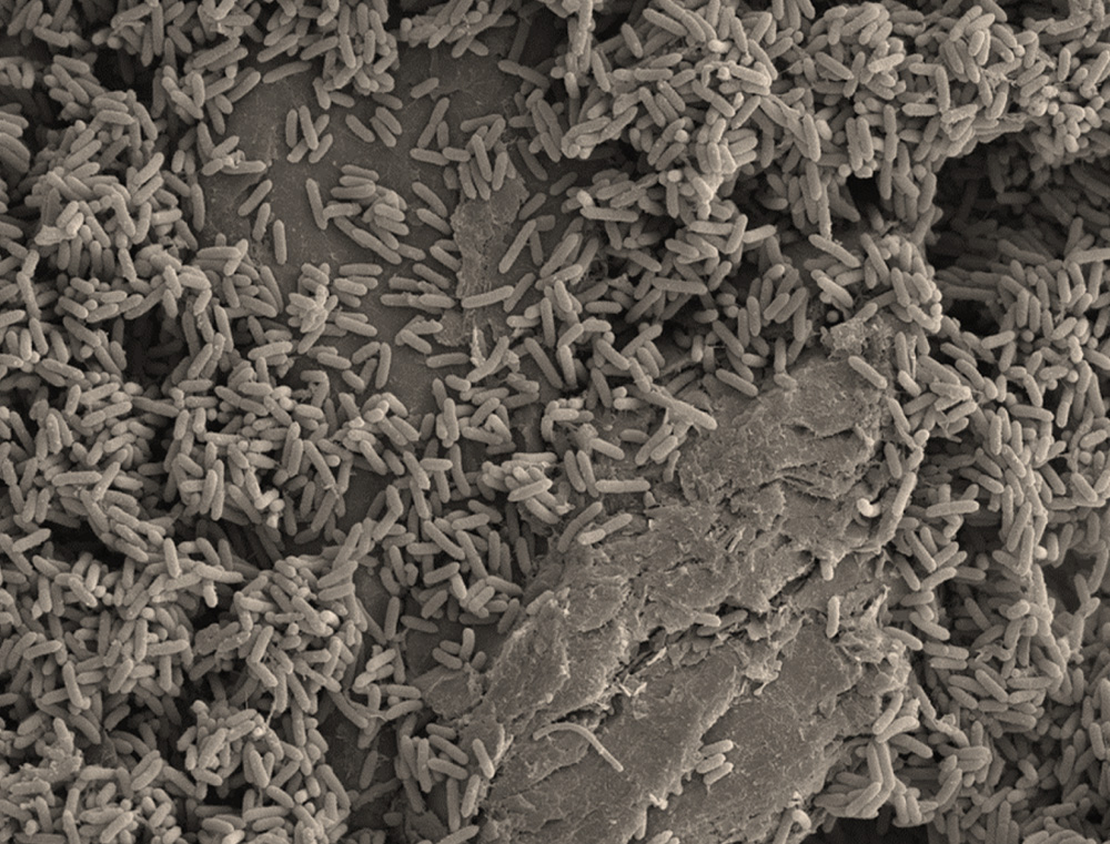 2_electroactive bacteria_1000.jpg