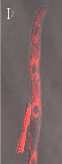 Subcellular localization of a GPCR-mRFP tagged fusion protein in hyphae of P. infestans