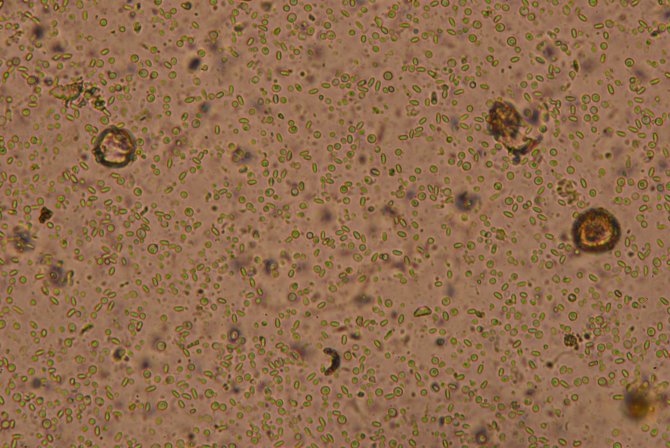 Nosema spp. in een monster genomen van het achterlijf van een honingbij bij een vergroting van 400x. De nosema-sporen zijn te herkennen als langwerpige cellen.