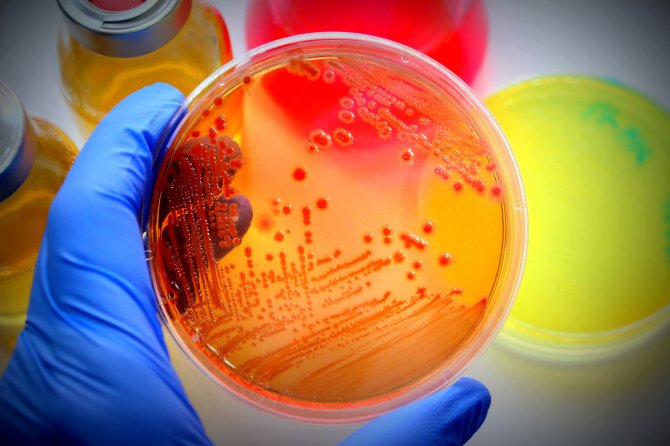 shutterstock_354853898_petrischaal_bacterie[1].jpg