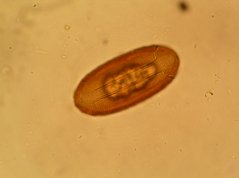 Egg of Callistoura isolated from Eulemur rubriventer using the centrifugation-sedimentation-flotation technique (CSF)