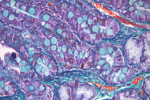 Pig gut cross section with Crossmon trichrome staining 