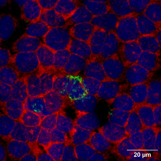 Highlighted in green, the presence of the Chlamydia bacteria.