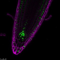 De worteltip van Arabidopsis thaliana. Celwanden zijn paars. Aux/IAA33, gefuseerd met een, fluorescente kleurstof, is zichtbaar in groen.