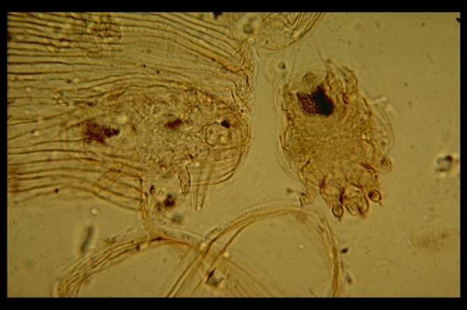 Trachee mijten (Acarapis woodi) onder een microscoop (40x).